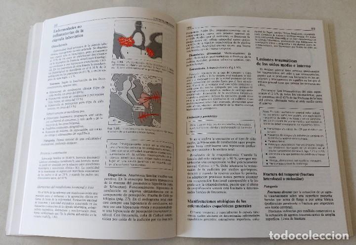 Libros de segunda mano: Libro Otorrinolaringologia - Foto 5
