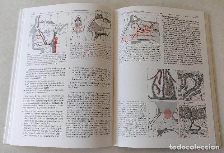 Libros de segunda mano: Libro Otorrinolaringologia - Foto 6
