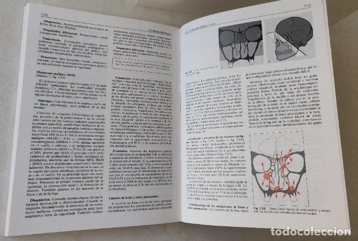 Libros de segunda mano: Libro Otorrinolaringologia - Foto 7