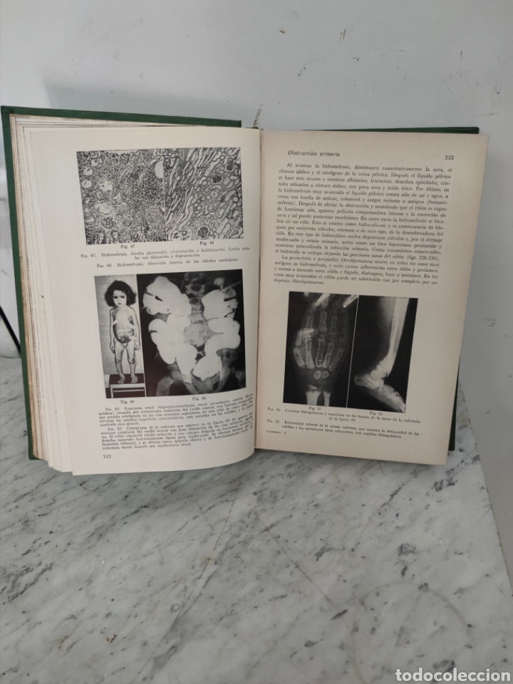 Libros de segunda mano: Urolog&iacute;a, Campbell 1958 - Foto 4