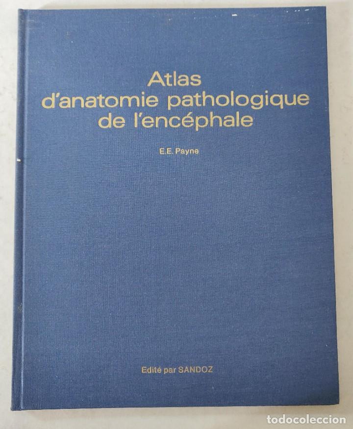 Libros de segunda mano: Libro Atlas DAnatomie Pathologique de LEncephale - Foto 1
