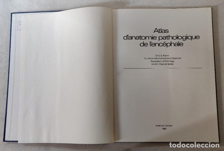 Libros de segunda mano: Libro Atlas DAnatomie Pathologique de LEncephale - Foto 3