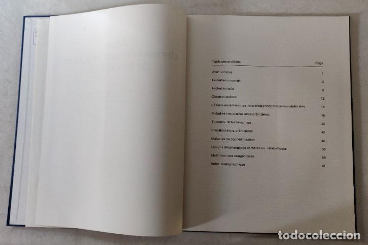 Libros de segunda mano: Libro Atlas DAnatomie Pathologique de LEncephale - Foto 4