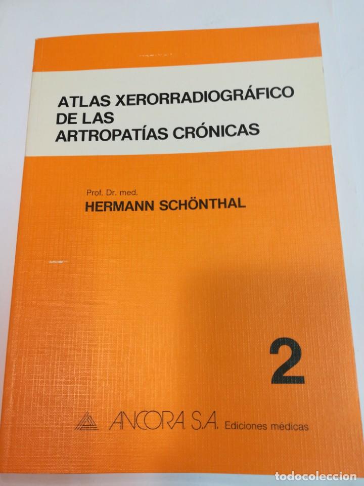 Libri di seconda mano: HERMANN SCHONTHAL Atlas xeorradiogr&aacute;fico de las artropatias cr&oacute;nicas SA4465