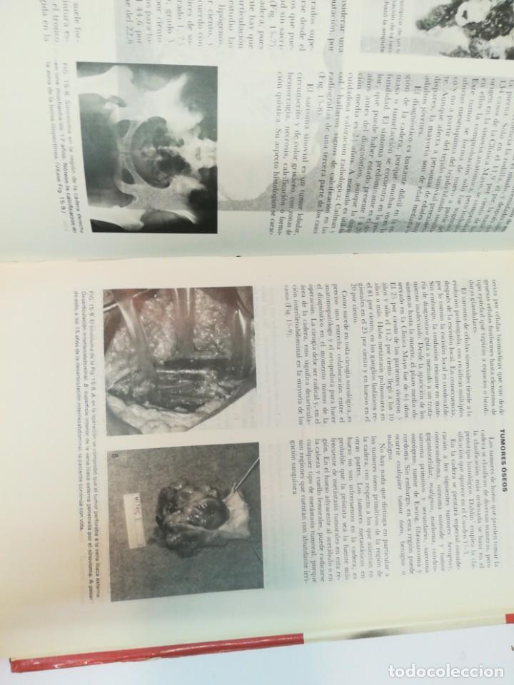 Libros de segunda mano: VV.AA Cirugia de cadera SA4469 - Foto 2