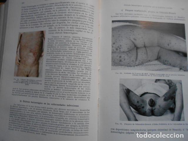 Libros de segunda mano: TRATADO DE PEDIATRIA EDITORIAL LABOR - Foto 3