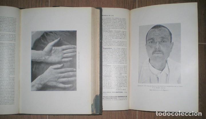 Libros de segunda mano: Sir Malcolm Morris: DICCIONARIO DE MEDICINA PRACTICA. 2 vols. Primera edici&oacute;n espa&ntilde;ola