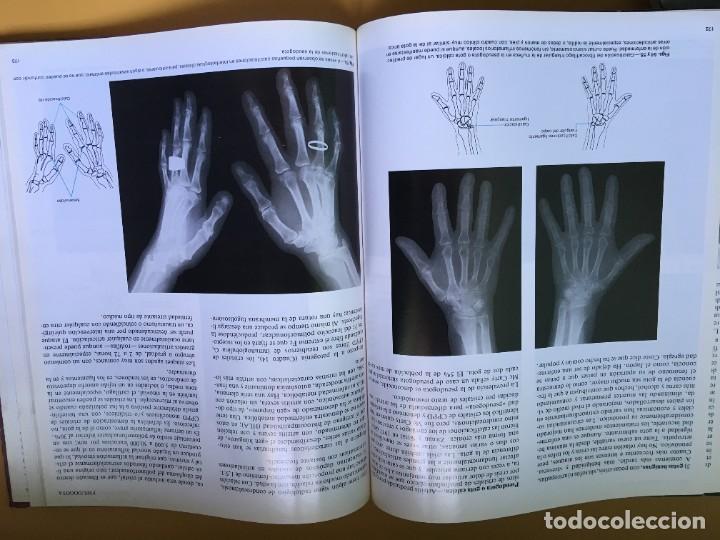 Libros de segunda mano: Atlas de Reumatologia - Foto 3