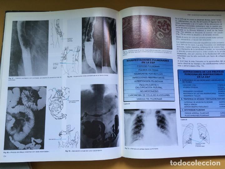 Libros de segunda mano: Atlas de Reumatologia - Foto 4