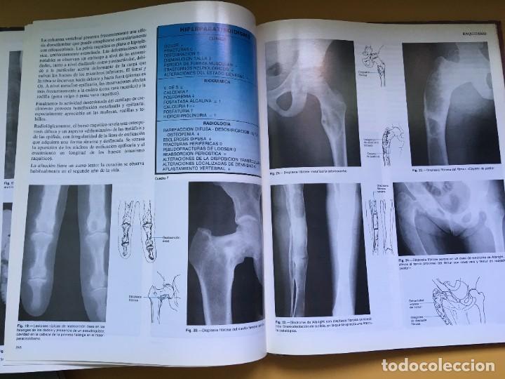 Libros de segunda mano: Atlas de Reumatologia - Foto 5