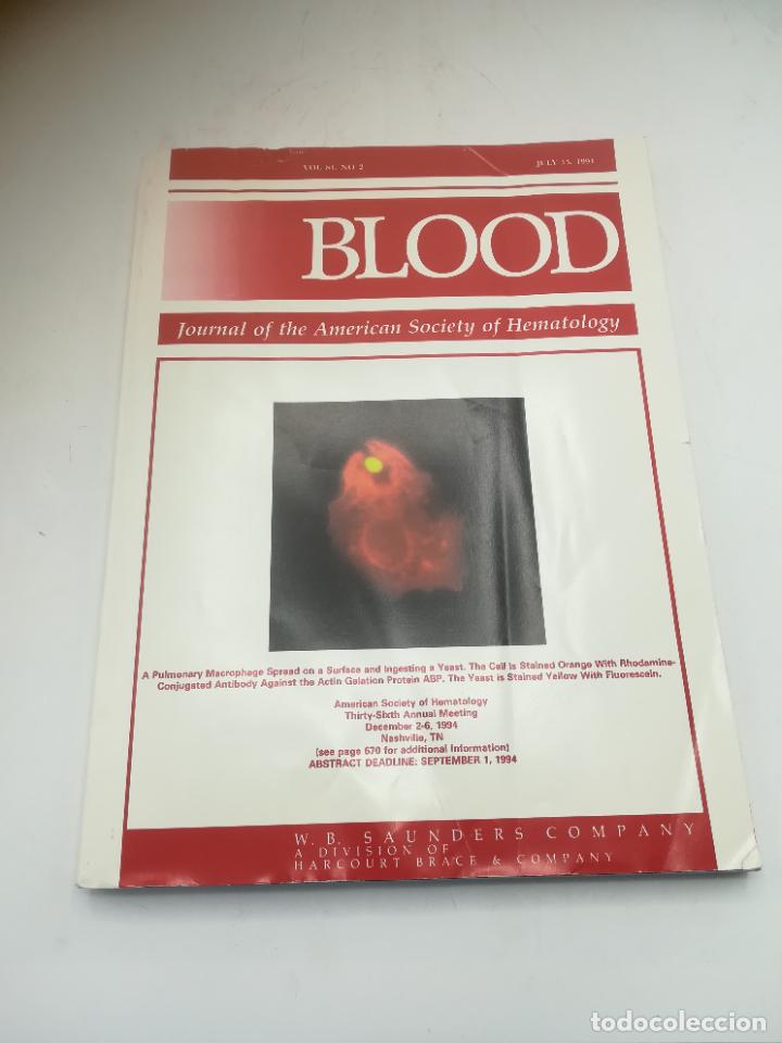 Second hand books: REVISTA MEDICINA. BLOOD. VOL.84. N&ordm; 2. JULIO 1994. JOURNAL OF THE AMERICAN SOCIETY OF HEMATOLOGY.