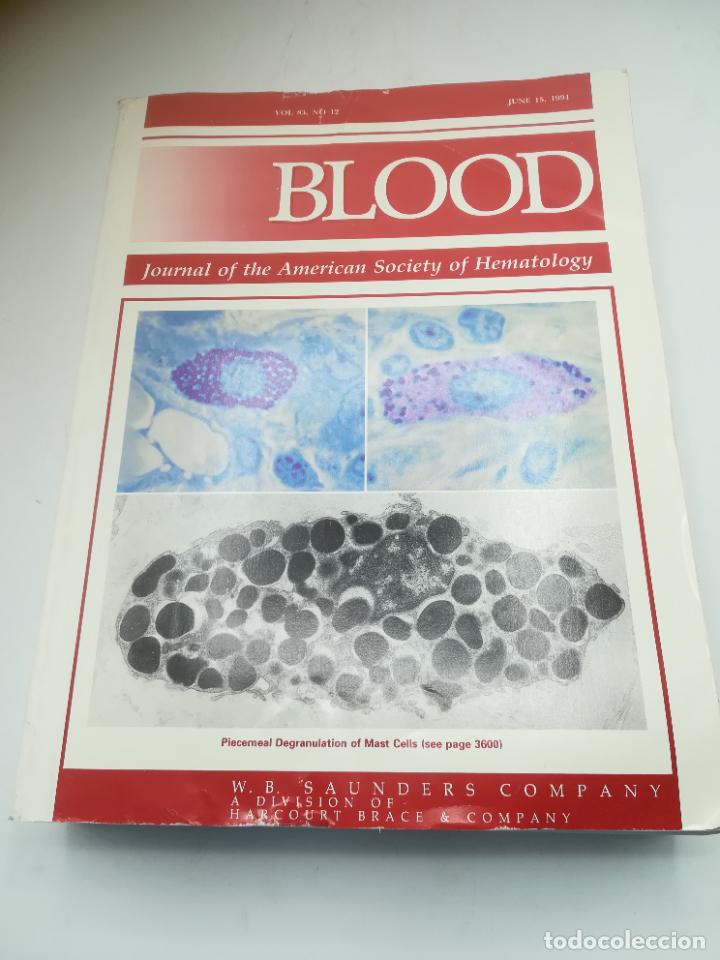Second hand books: REVISTA MEDICINA. BLOOD. VOL.83. N&ordm; 12. JULIO 1994. JOURNAL OF THE AMERICAN SOCIETY OF HEMATOLOGY.