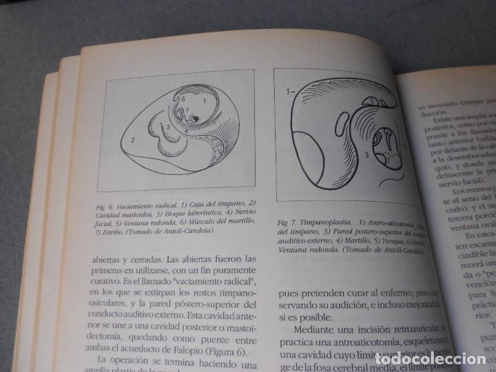 Libros de segunda mano: OTORRINOLARINGOLOGIA BASICA - Foto 6