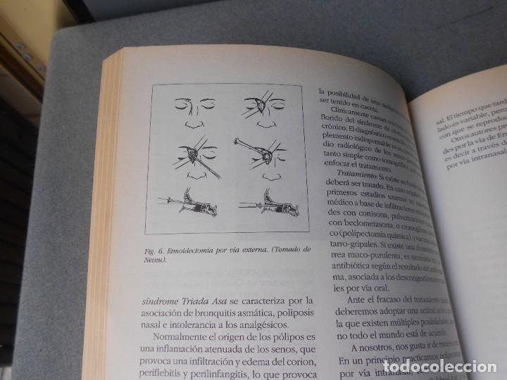 Libros de segunda mano: OTORRINOLARINGOLOGIA BASICA - Foto 7