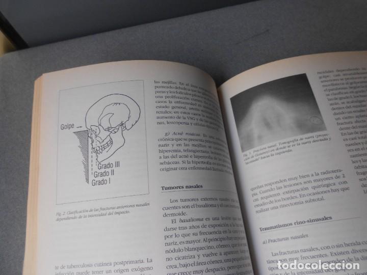 Libros de segunda mano: OTORRINOLARINGOLOGIA BASICA - Foto 8
