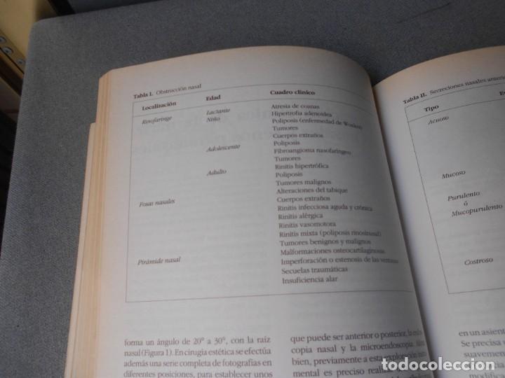 Libros de segunda mano: OTORRINOLARINGOLOGIA BASICA - Foto 9