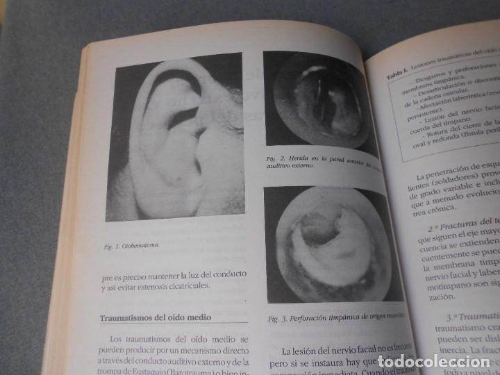 Libros de segunda mano: OTORRINOLARINGOLOGIA BASICA - Foto 10