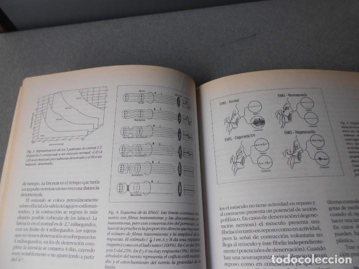 Libros de segunda mano: OTORRINOLARINGOLOGIA BASICA - Foto 11