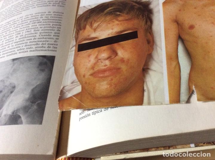 Libros de segunda mano: Gran enciclopedia de la Salud - Foto 2