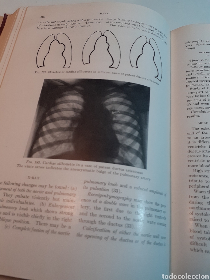 Libros de segunda mano: Heart, Aldo A. Luisada, ingl&eacute;s, 1948 - Foto 10