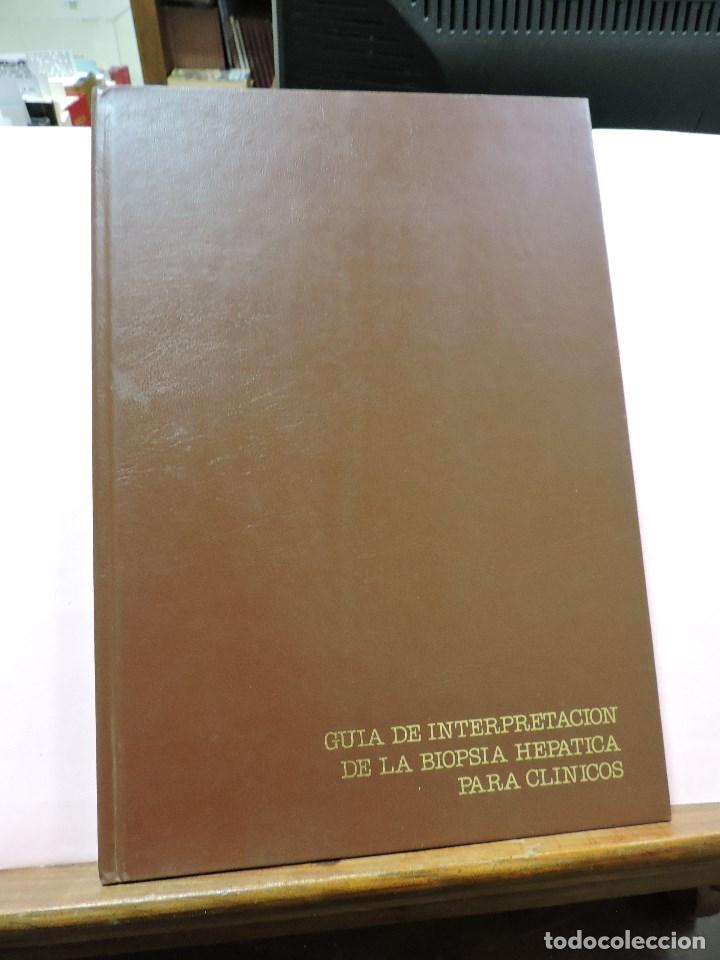 Second hand books: Gu&iacute;a de interpretaci&oacute;n de la biopsia hep&aacute;tica para cl&iacute;nicos. Editorial Glaxo Elba 1989