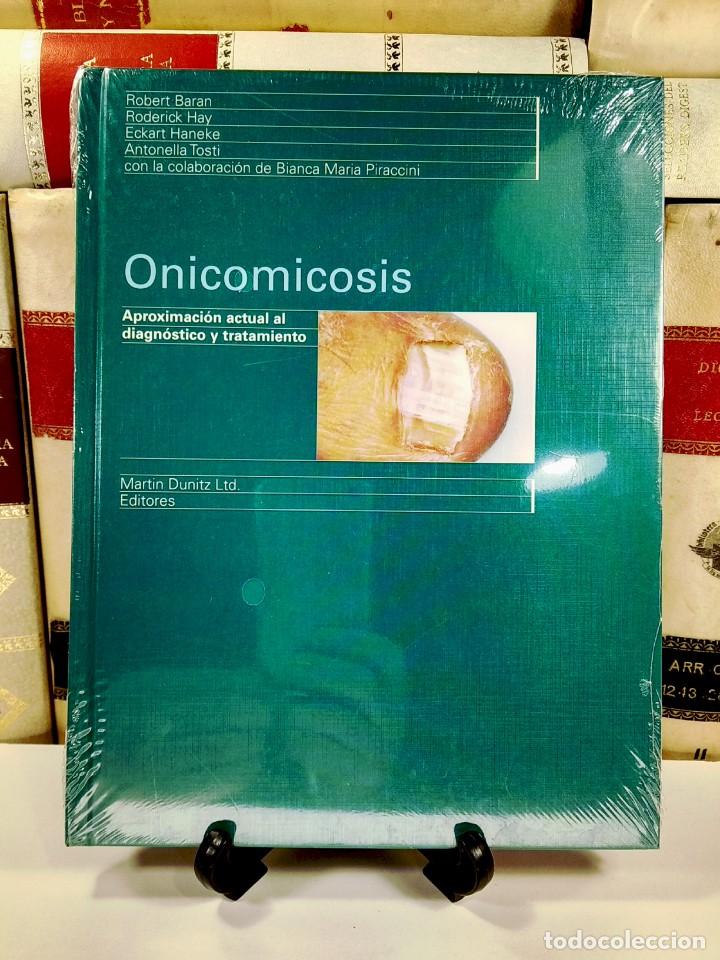 Libri di seconda mano: ONICOMICOSIS. Aproximaci&oacute;n actual al diagn&oacute;stico y tratamiento. VV.AA. Mart&iacute;n Dunitz Ltd Editores.