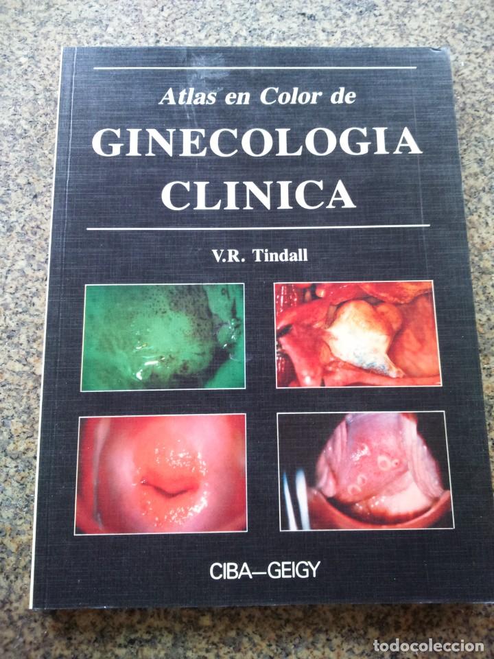 Second hand books: ATLAS EN COLOR DE GINECOLOGIA CLINICA -- V. R. TINDALL -- 1990 --