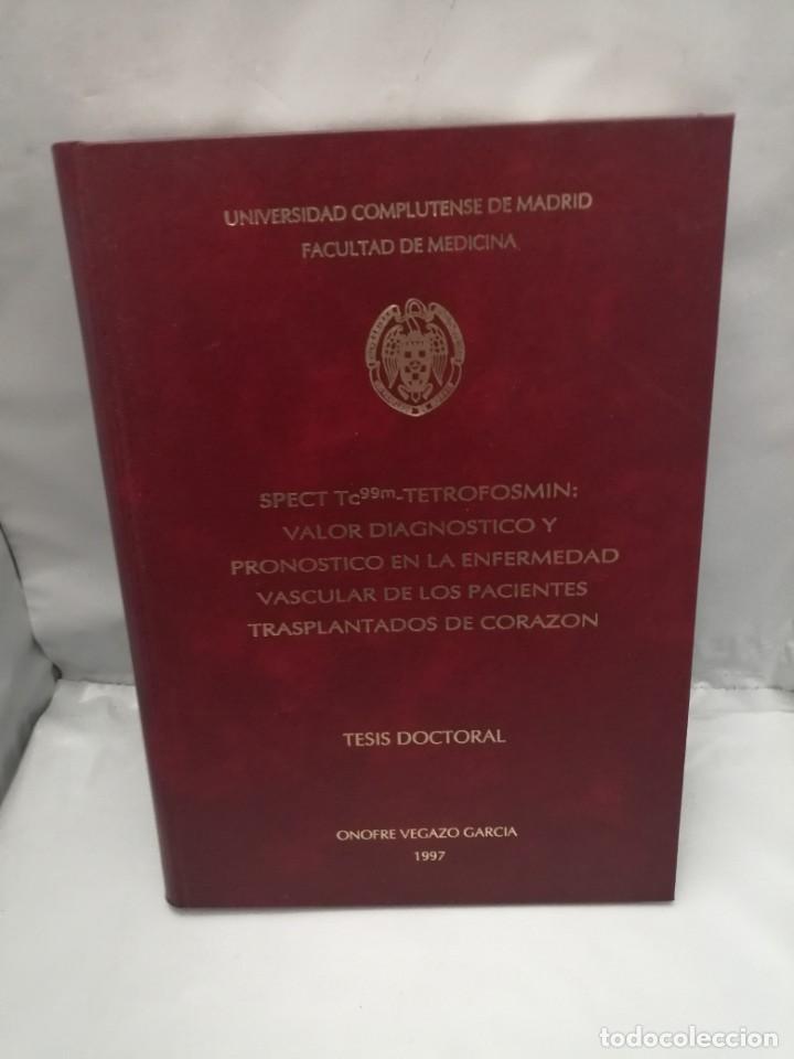 Second hand books: SPECT TC99M-TETROFOSMIN (DEDICATORIA Y FIRMA AUT&Oacute;GRAFA DE AUTOR)
