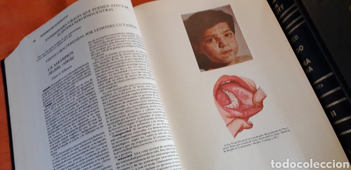 Libros de segunda mano: TRATADO DE MEDICINA INTERNA, DE CECIL-LOEB, - Foto 6