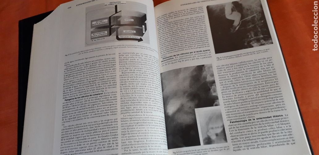 Libros de segunda mano: TRATADO DE MEDICINA INTERNA, DE CECIL-LOEB, - Foto 9