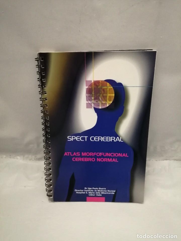 Second hand books: SPECT CEREBRAL ATLAS MORFOFUNCIONAL CEREBRO NORMAL