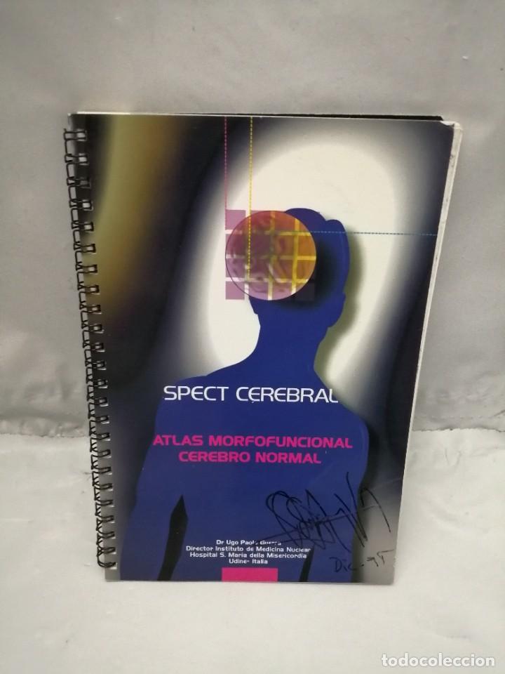 Second hand books: SPECT CEREBRAL: ATLAS MORFOFUNCIONAL CEREBRO NORMAL