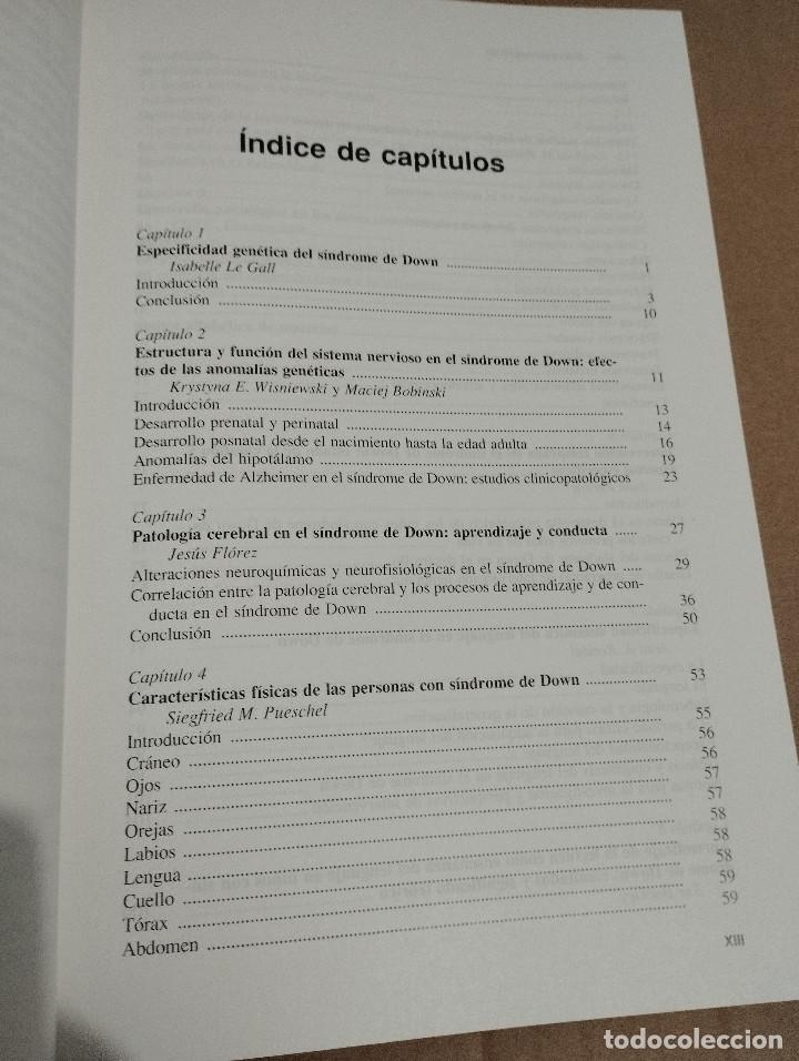 Libros de segunda mano: S&Iacute;NDROME DE DOWN. ASPECTOS ESPEC&Iacute;FICOS (JUAN PERERA) - Foto 3