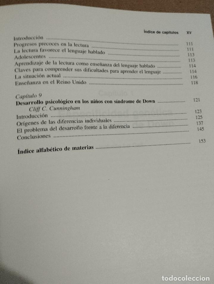 Libros de segunda mano: S&Iacute;NDROME DE DOWN. ASPECTOS ESPEC&Iacute;FICOS (JUAN PERERA) - Foto 5