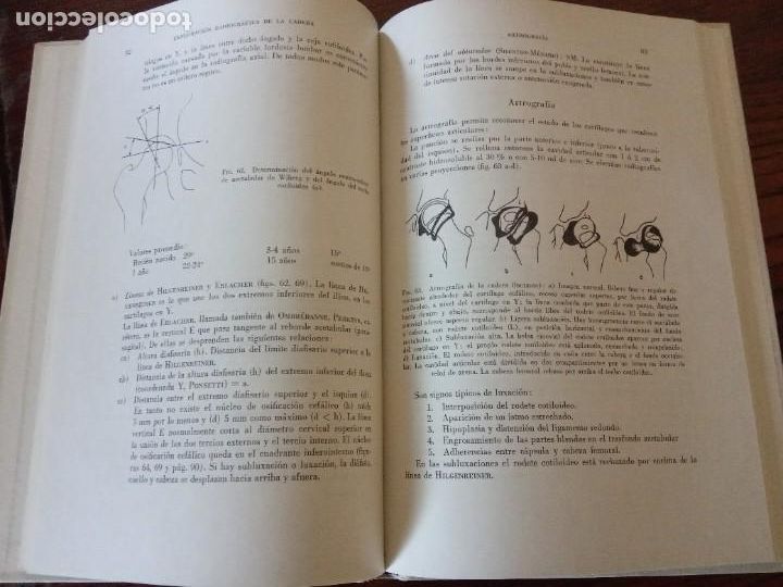Libros de segunda mano: Diagn&oacute;stico ortop&eacute;dico. - Hans U. Debrunner. - Foto 3