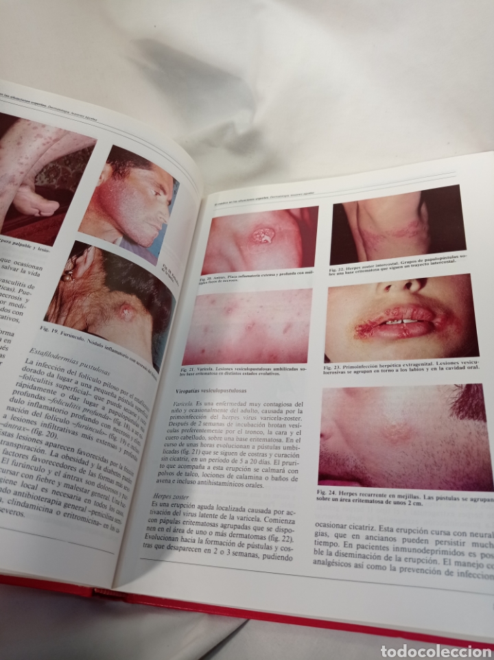Libros de segunda mano: URGENCIAS EN LA PR&Aacute;CTICA M&Eacute;DICA - Foto 2