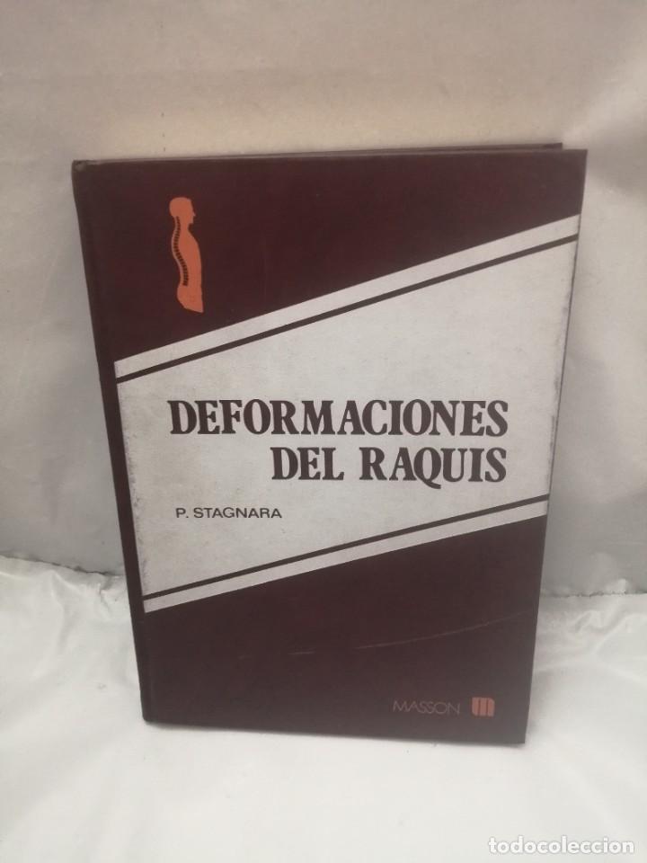 Libri di seconda mano: DEFORMACIONES DEL RAQUIS: ESCOLIOSIS, CIFOSIS Y LORDOSIS (CONTIENE SUBRAYADOS EN PRIMERAS 105 PAGS.)