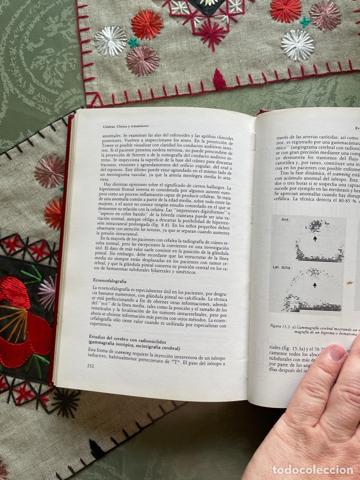 Libros de segunda mano: Cefaleas y su tratamiento (James LAnce) - Foto 2