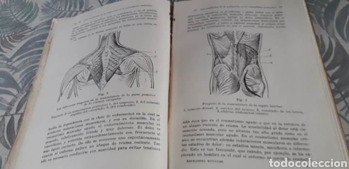 Libros de segunda mano: REUMATISMO MUSCULAR, PROF. DR. ,MAX LANGE, - Foto 6