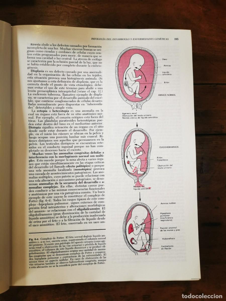 Libros de segunda mano: RUBIN, Emanuel. Patolog&iacute;a - Foto 3
