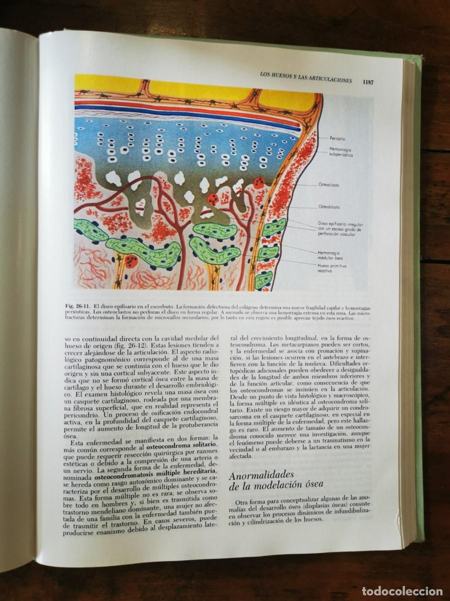 Libros de segunda mano: RUBIN, Emanuel. Patolog&iacute;a - Foto 5