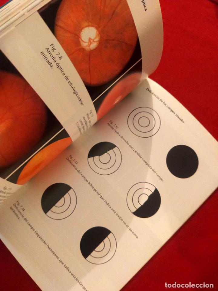 Libros de segunda mano: ATLAS EN COLOR DE OFTALMOLOGIA - Foto 3