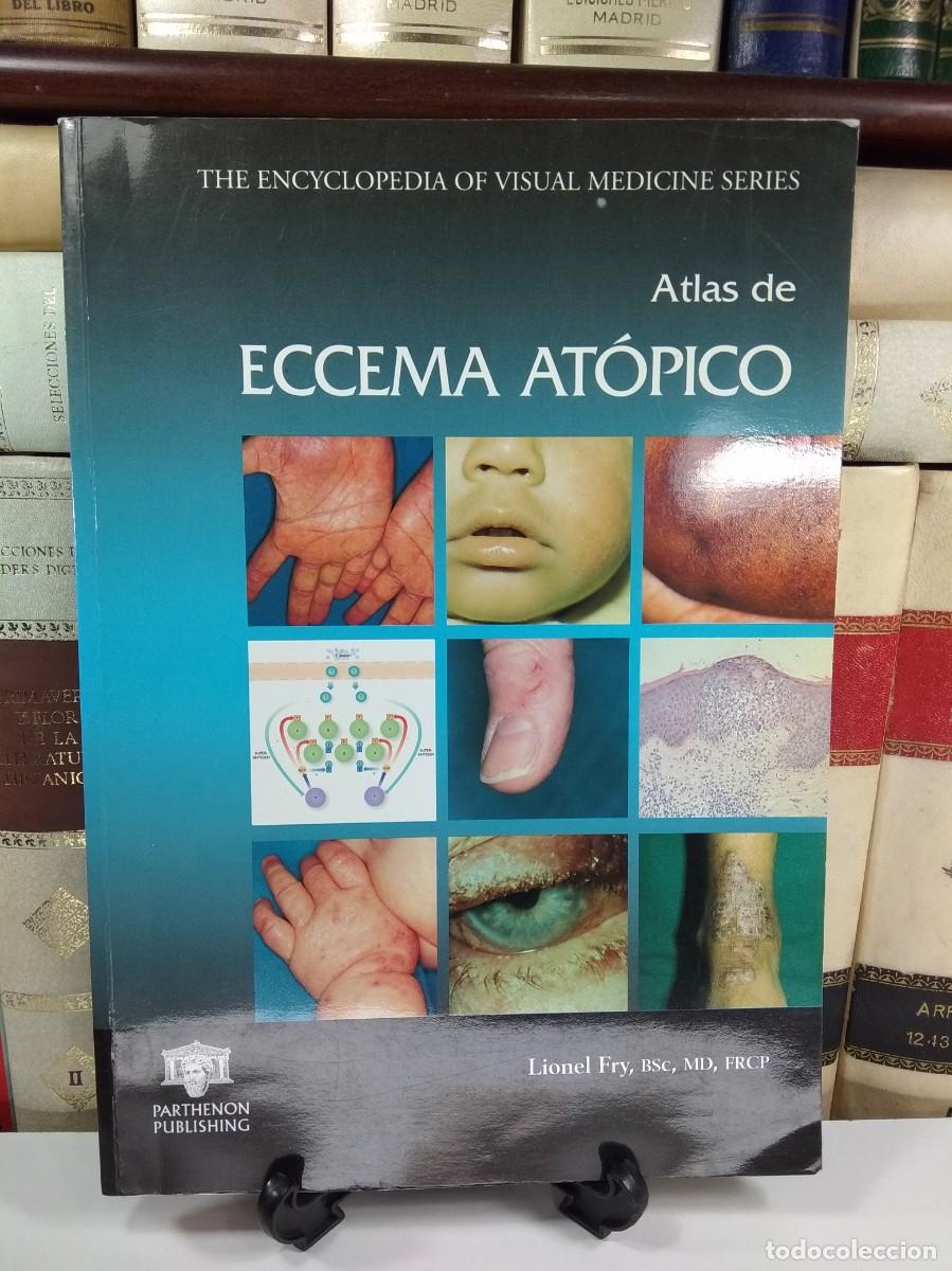 Second hand books: ATLAS DE ECCEMA AT&Oacute;PICO. The Encyclopedia of Visual Medicine series. A&ntilde;o 2004