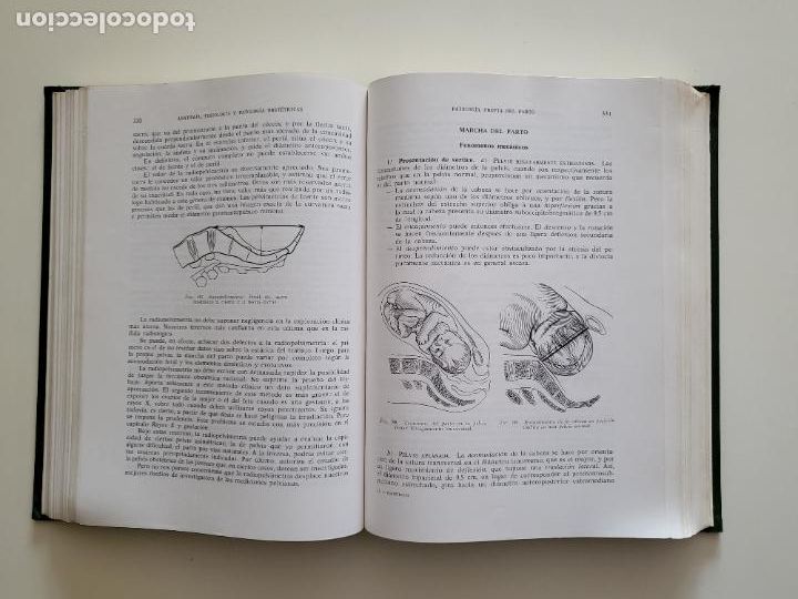 Libros de segunda mano: MANUAL DE OBSTETRICIA - ROBERT MERGER 1964 - Foto 3