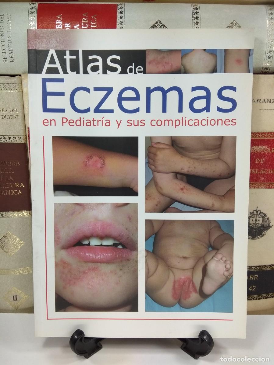Second hand books: ATLAS DE ECZEMAS EN PEDIATR&Iacute;A Y SUS COMPLICACIONES. ISBN: 9788477142881.