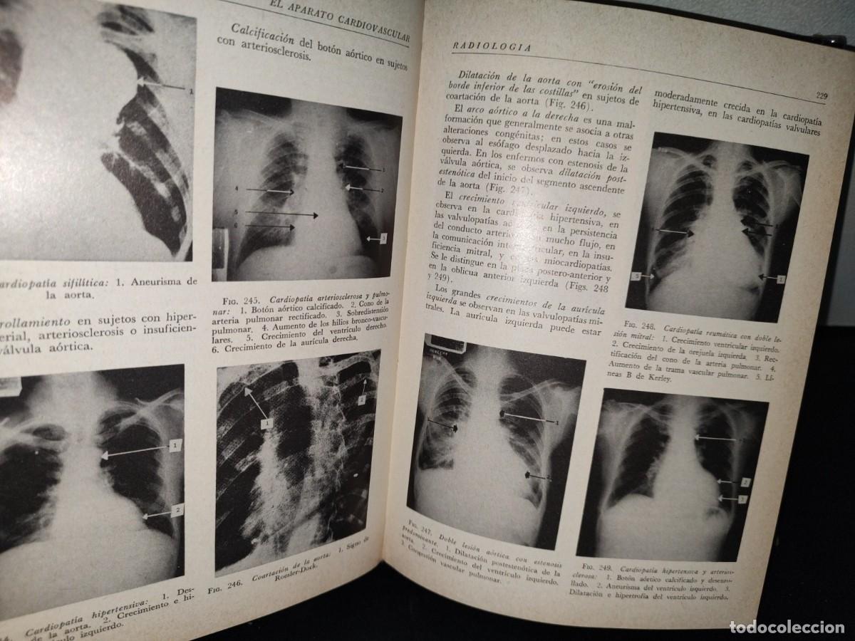 Libros de segunda mano: 52- FUNDAMENTOS DEL DIAGN&Oacute;STICO - JAVIER CASTILLO NAVA - Foto 15