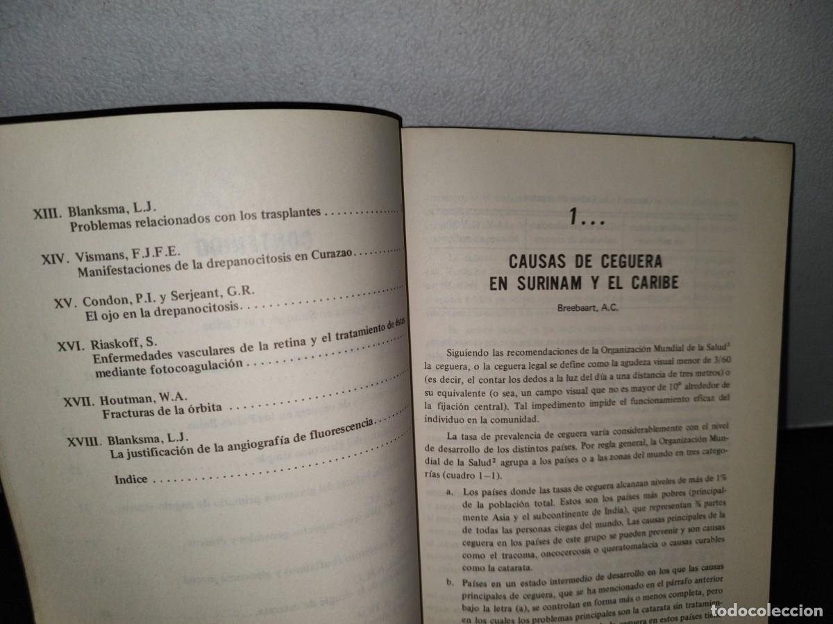 Libros de segunda mano: 53- OFTALMOLOG&Iacute;A - N. M. J. SCHWEITZER - Foto 5