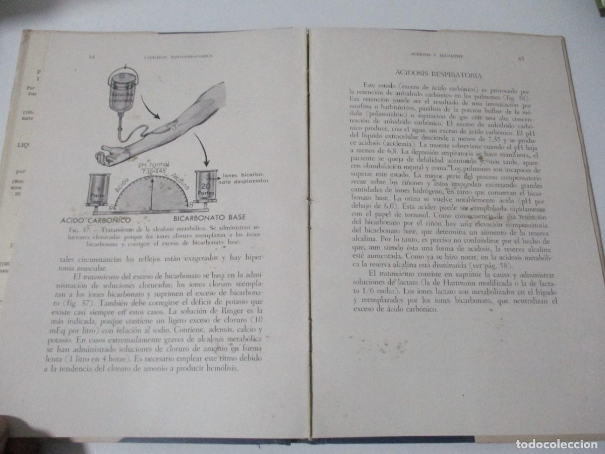 Libros de segunda mano: PHILIP THOREK Pre y post operatorio ilustrado W16213 - Foto 4