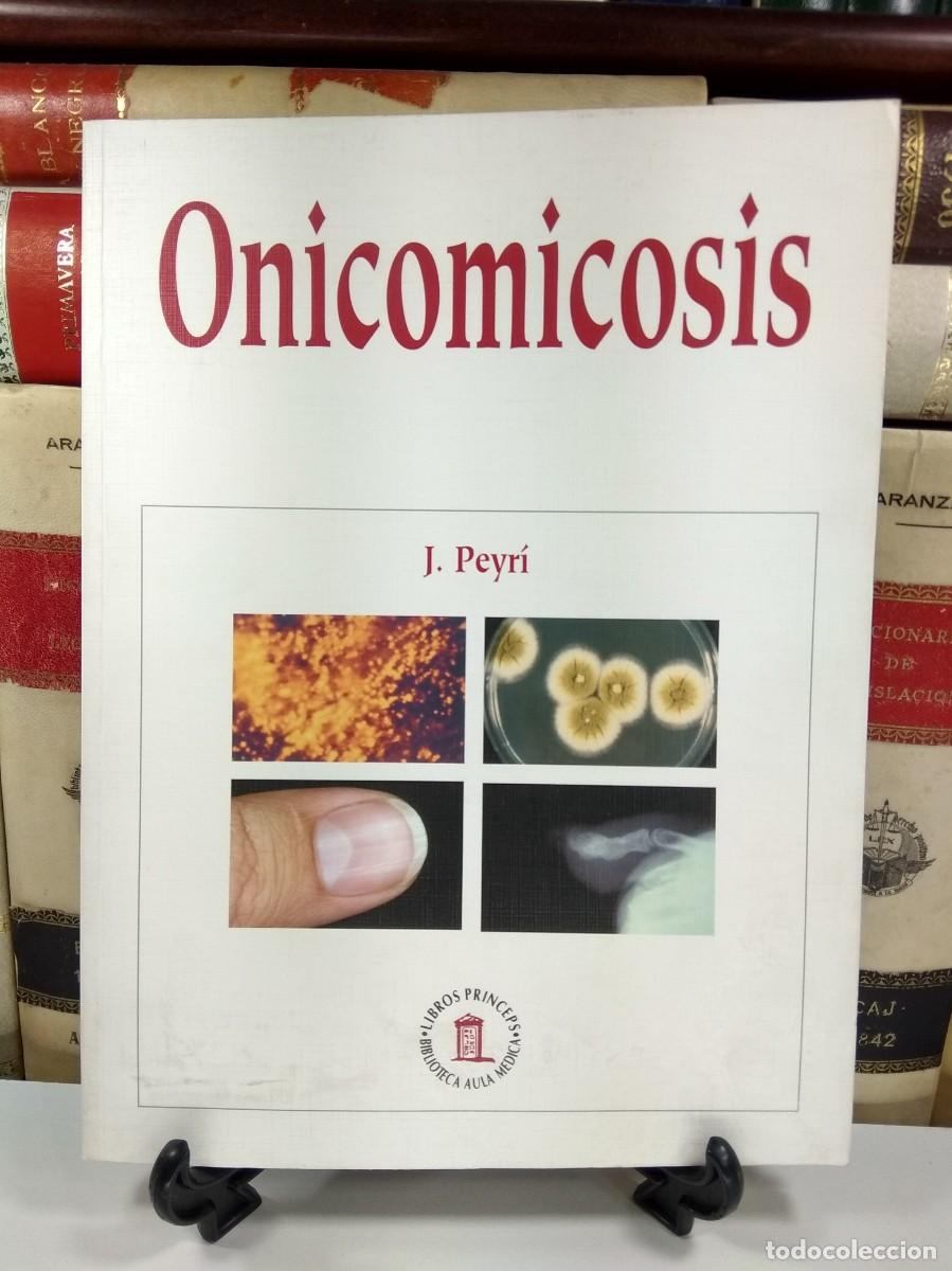 Second hand books: ONICOMICOSIS. PEYR&Iacute;, J. Libros Princeps. A&ntilde;o 2002. ISBN: 8478852867