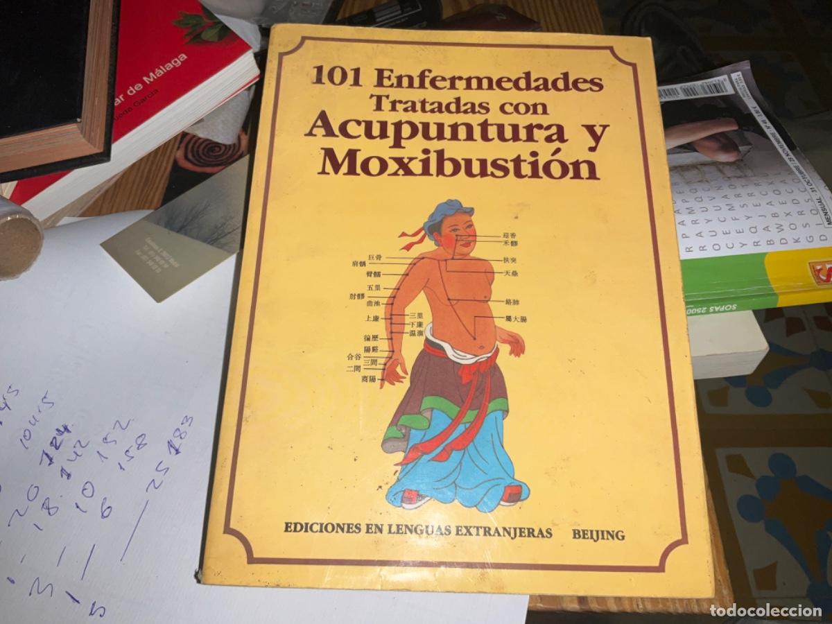 Gebrauchte B&uuml;cher: 101 ENFERMEDADES TRATADAS CON ACUPUNTURA Y MOXIBUSTI&Oacute;N